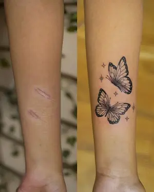 TATTOO REMOVAL & COVER-UP — Rathnam Tattoos Studio